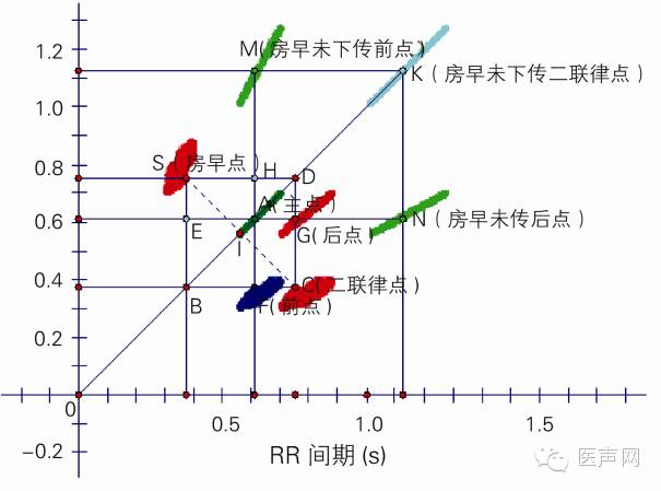 心电散点图表达的心脏电生理现象