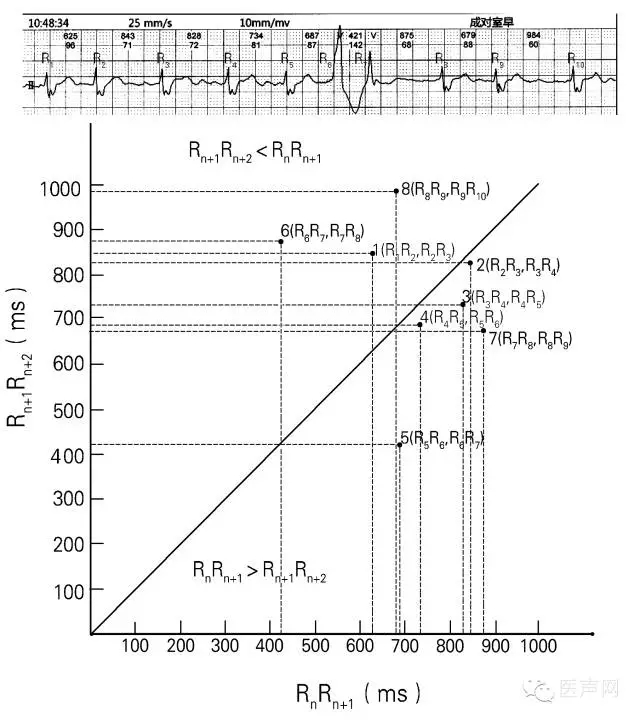 心律的整体观——认识和解读RR间期散点图