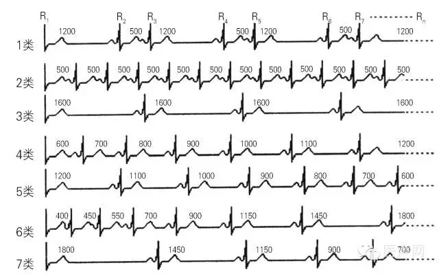 心律的整体观——认识和解读RR间期散点图