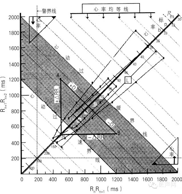 心律的整体观——认识和解读RR间期散点图