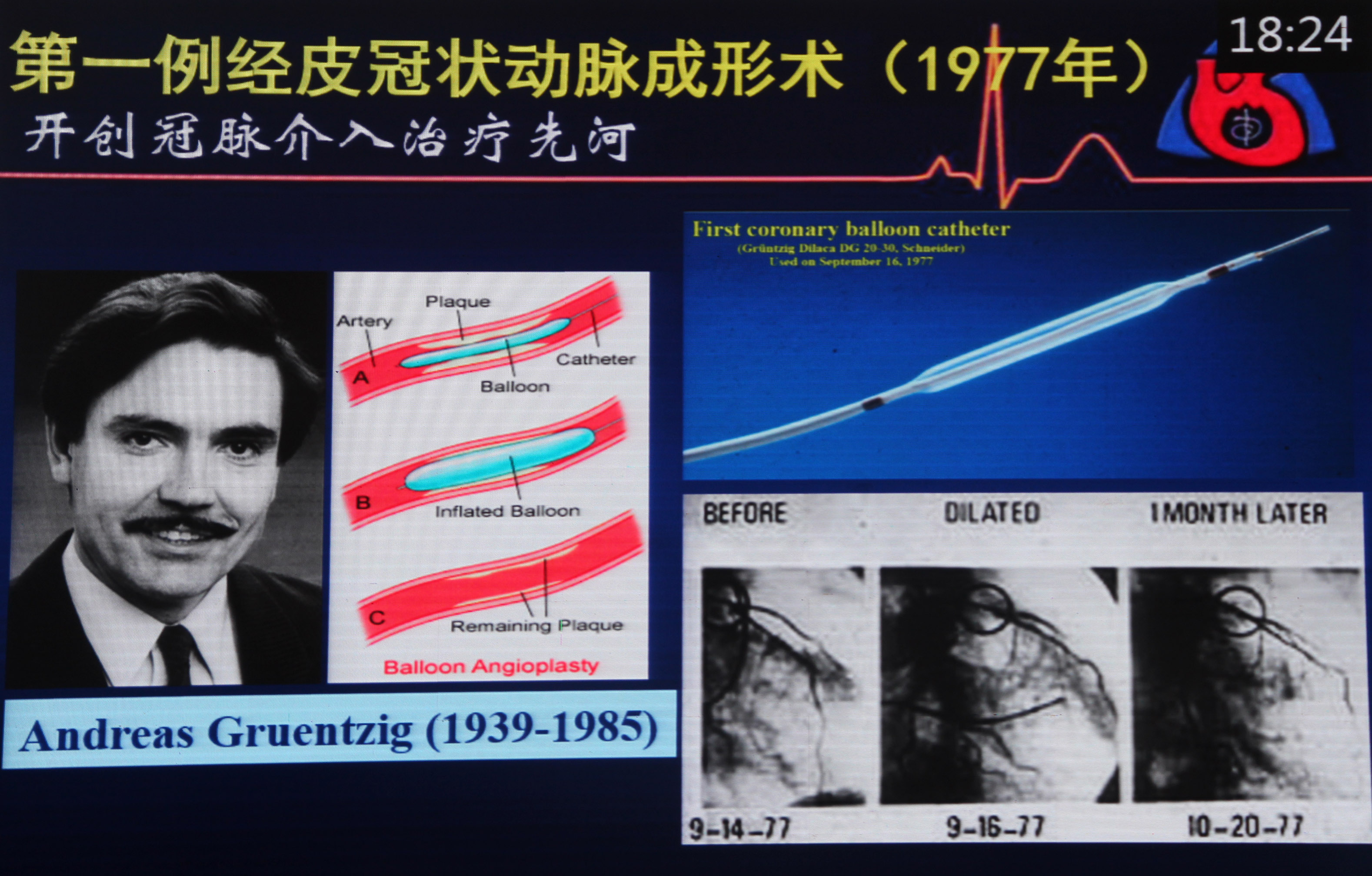 葛均波:创新充满艰辛 进步永无止境