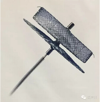 不一样的左心耳封堵器ACP宣布在中国正式上市