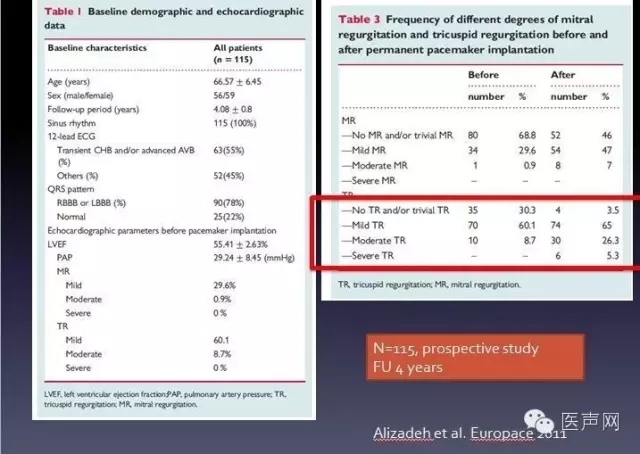 姚启恒:起搏器植入对三尖瓣返流影响
