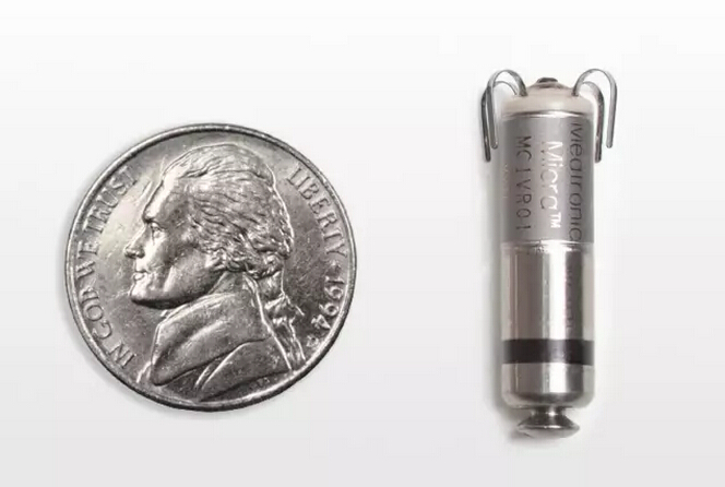 微型无导线起搏器Micra获FDA批准上市