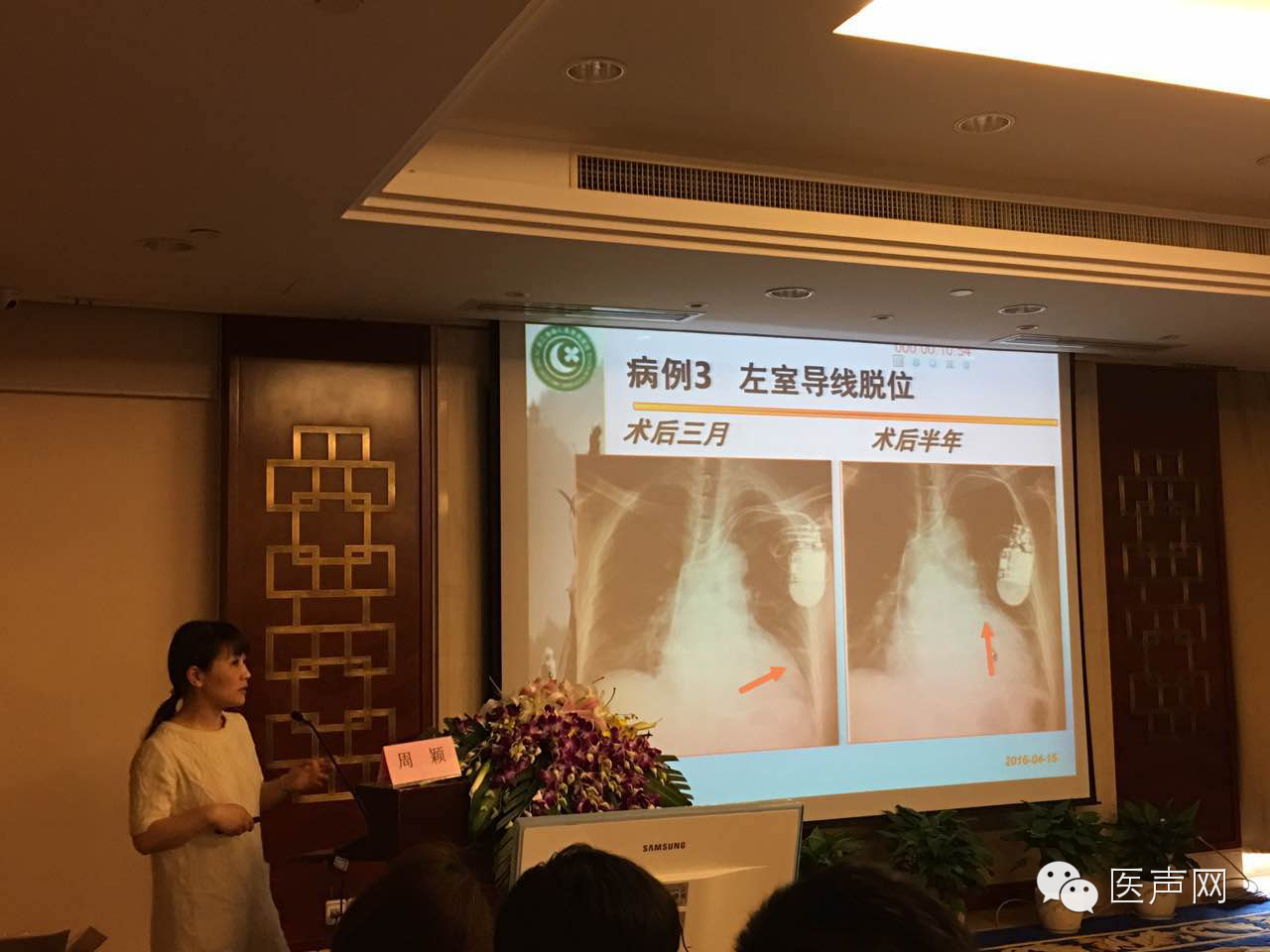 说明: https://mmbiz.qlogo.cn/mmbiz/hfau27COcrDyCfWSpkRjjjNP6Y1J4gq1qb6zunEIRxibBfBFP7K7RJwRGFvty926S3mId6gic8Os2jwNorSN70ng/0?wx_fmt=png