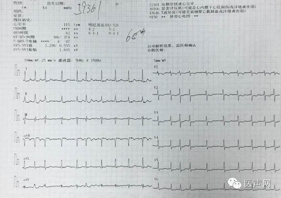 说明: https://mmbiz.qlogo.cn/mmbiz/hfau27COcrATPFPpaZo52GQ0icVF87WS32mM4rKrYwloxtxdHIqhLYH2GXZjiayroFtsUrKiaEfNwUlLDWSlav7aA/0?wx_fmt=png