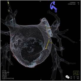 说明: https://mmbiz.qlogo.cn/mmbiz/hfau27COcrATPFPpaZo52GQ0icVF87WS3IaZ8RSuT1VHY6JvB3GCqJibcRcZiam1V2IIdt2icKaDmdvHJP6UyVMCkQ/0?wx_fmt=png