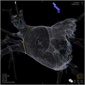 说明: https://mmbiz.qlogo.cn/mmbiz/hfau27COcrATPFPpaZo52GQ0icVF87WS3YaDDYfk2mLjk5dbp0MwEk2sS2XJ6FjiajxHIxeCiaQ2G2nP7iahKibIOIw/0?wx_fmt=png