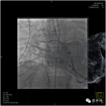 说明: https://mmbiz.qlogo.cn/mmbiz/hfau27COcrATPFPpaZo52GQ0icVF87WS3GjnN5w4XSg8ACwsLmcdMmZVN0KbBcxOD0gNJmibjIUszeshE6Eqg6yw/0?wx_fmt=png