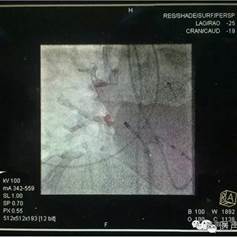 说明: https://mmbiz.qlogo.cn/mmbiz/hfau27COcrATPFPpaZo52GQ0icVF87WS3z33hqbmlPwPmSkiboPsajy2GlnHMPWFnH9Sh1q5okxwB6ibX10BaA1ow/0?wx_fmt=jpeg