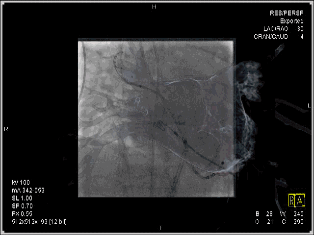 说明: https://mmbiz.qlogo.cn/mmbiz/hfau27COcrATPFPpaZo52GQ0icVF87WS3fmiaicltbIw0AWCZVXWoq3fM3M90H3TaWF1avWWwo7bPrfrNwQNs9RjA/0?wx_fmt=gif