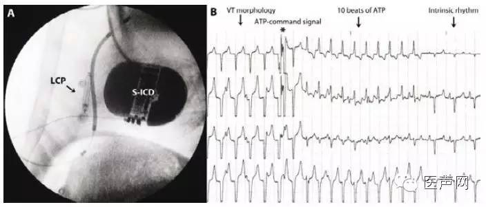说明: https://mmbiz.qlogo.cn/mmbiz/hfau27COcrCAbxr2UVEj9oCFicnRrWE3lXQDZx7XEPoKKuibjfnwAWflcQoJVVSx5bzTGOSBibLia3nkT7Uib2ulysg/0?wx_fmt=jpeg