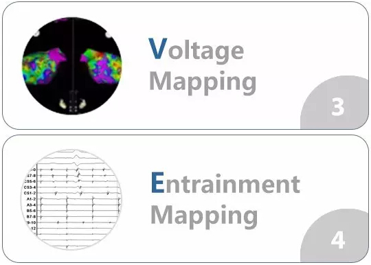 HRS 2016 | 广东省医HAVE术式