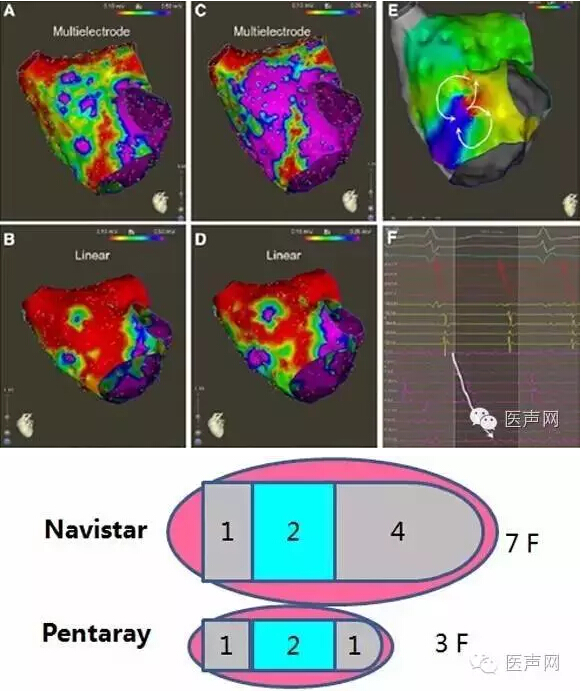 HRS 2016 | 广东省医HAVE术式