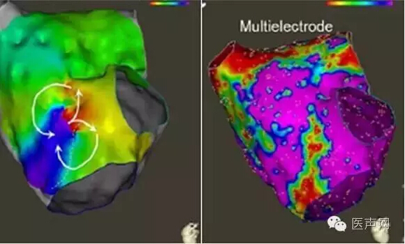 HRS 2016 | 广东省医HAVE术式