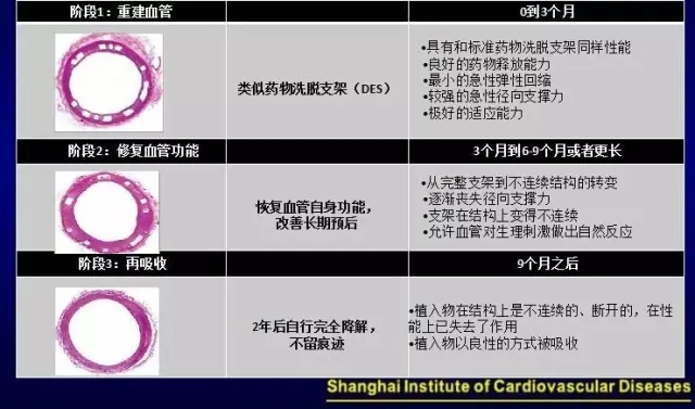完全可降解支架引领第四代冠脉介入治疗革命