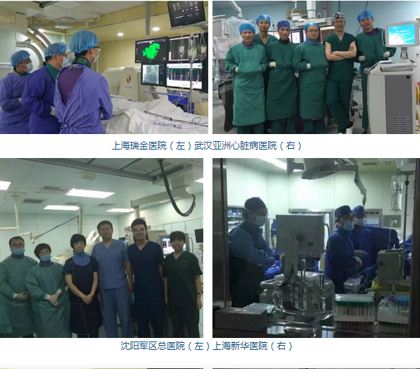 首批第二代球囊型冷冻消融导管在中国开展应用