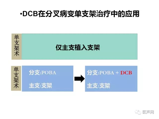 切割球囊联合药物球囊/心球联盟——复杂冠脉病变精锐研讨会第二站在京成功举行