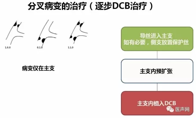 切割球囊联合药物球囊/心球联盟——复杂冠脉病变精锐研讨会第二站在京成功举行