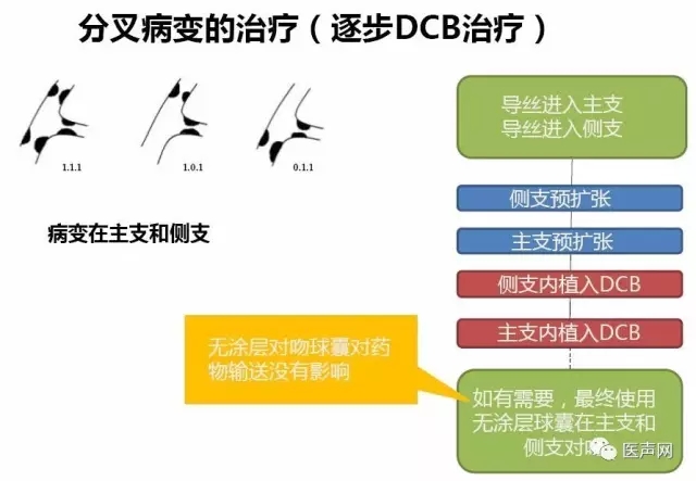 切割球囊联合药物球囊/心球联盟——复杂冠脉病变精锐研讨会第二站在京成功举行