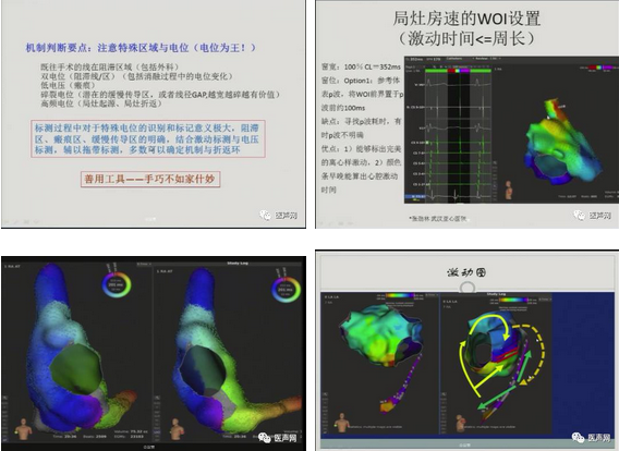 标精例益——Rhythmia高密度标测峰会全程回顾