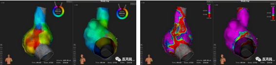 标精例益——Rhythmia高密度标测峰会全程回顾