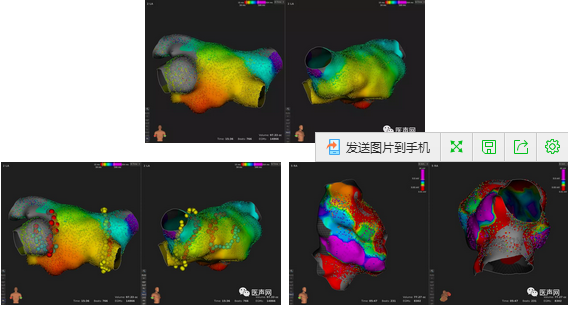 标精例益——Rhythmia高密度标测峰会全程回顾