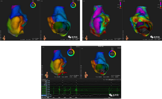 标精例益——Rhythmia高密度标测峰会全程回顾