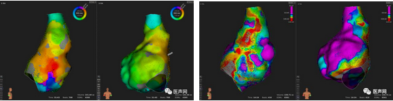 标精例益——Rhythmia高密度标测峰会全程回顾