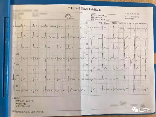 陈永清:晕厥患者辗转就医,期待Reveal LINQ明确病因