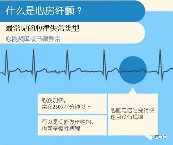 莆田市第一医院成功开展冷冻消融房颤新疗法
