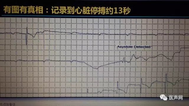 携手创新 律动生命——众专家共同探讨预防心脏性猝死的第一道防线
