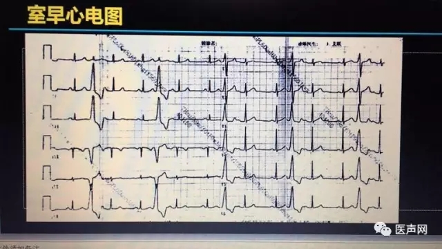 携手创新 律动生命——众专家共同探讨预防心脏性猝死的第一道防线