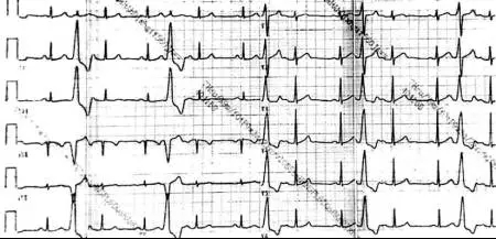 董颖雪:晕厥诊断的利器