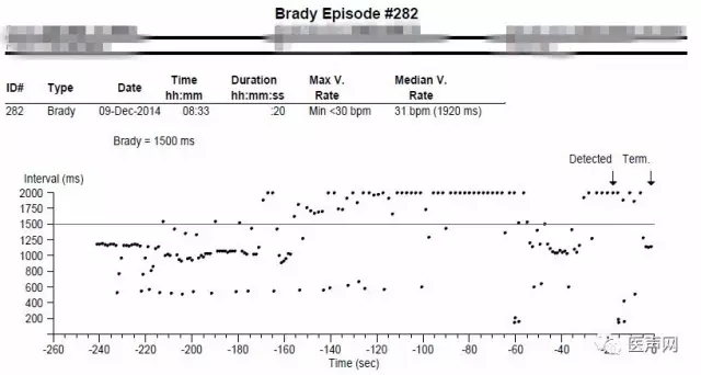 董颖雪:晕厥诊断的利器
