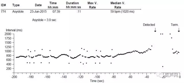 董颖雪:晕厥诊断的利器