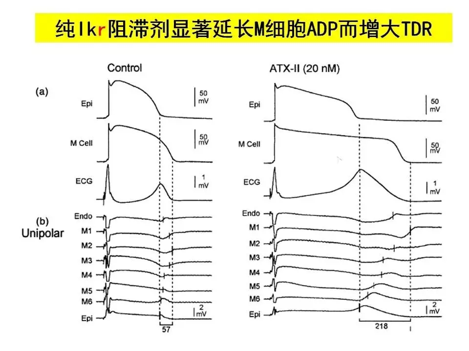 舒茂琴:抗心律失常药物临床应用——老药新用