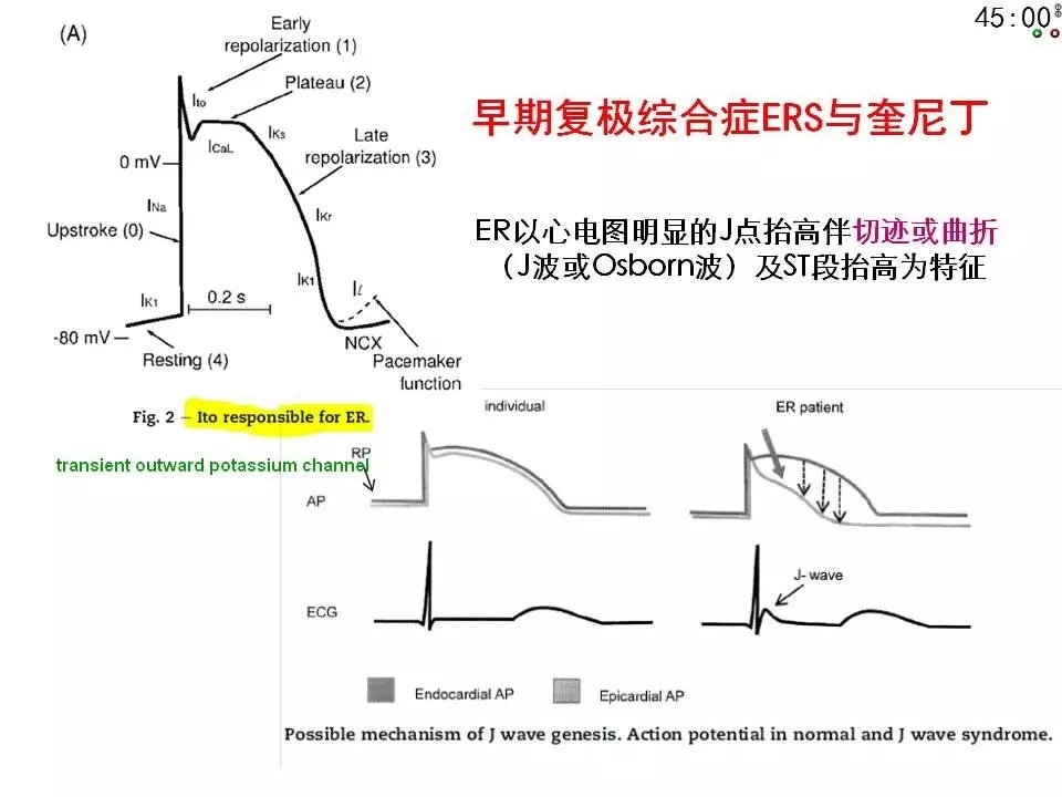 舒茂琴:抗心律失常药物临床应用——老药新用
