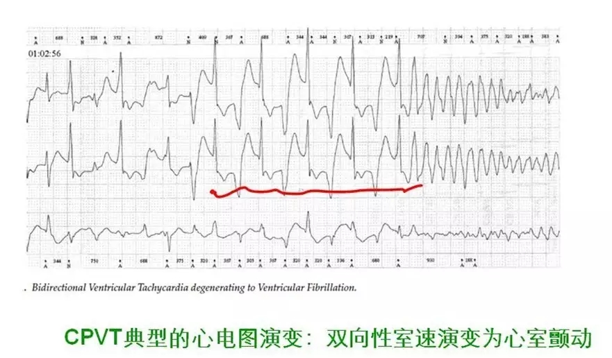舒茂琴:抗心律失常药物临床应用——老药新用