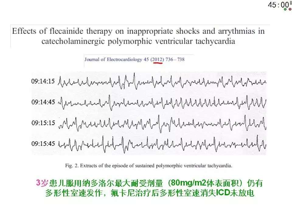 舒茂琴:抗心律失常药物临床应用——老药新用
