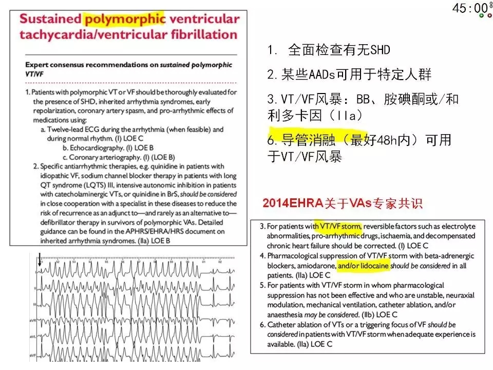 舒茂琴:抗心律失常药物临床应用——老药新用