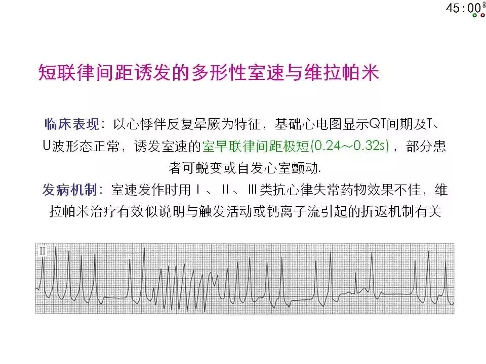 舒茂琴:抗心律失常药物临床应用——老药新用