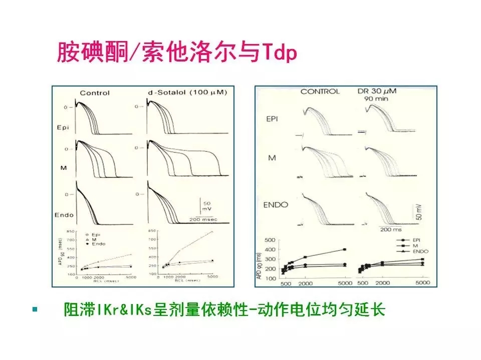 舒茂琴:抗心律失常药物临床应用——老药新用