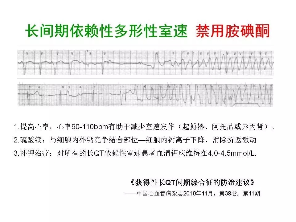 舒茂琴:抗心律失常药物临床应用——老药新用