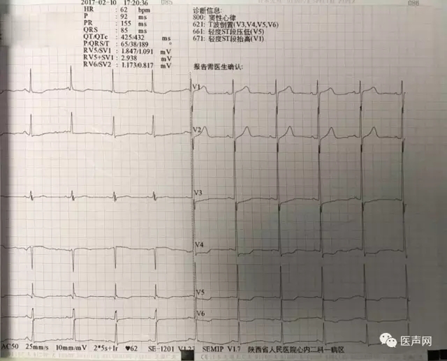 姚晓伟:陕西省人民医院首例-ICM