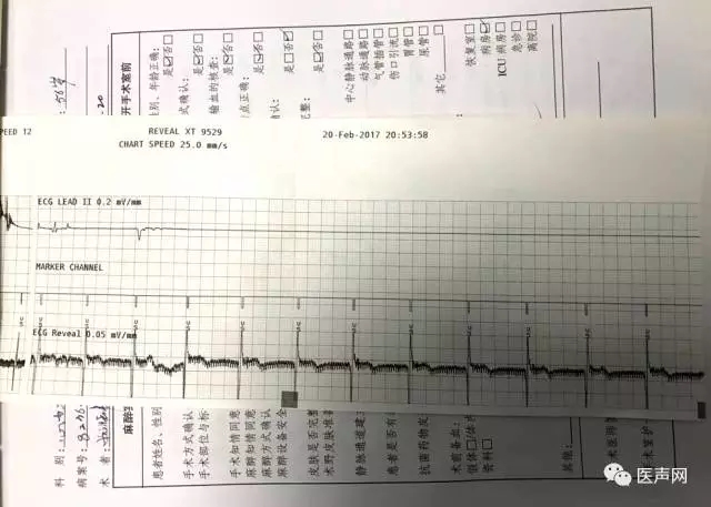 姚晓伟:陕西省人民医院首例-ICM