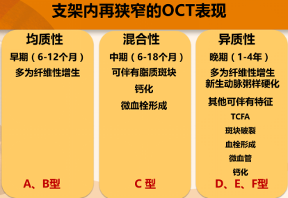 时空连线 OCT 在支架内再狭窄诊断及治疗中的价值和意义