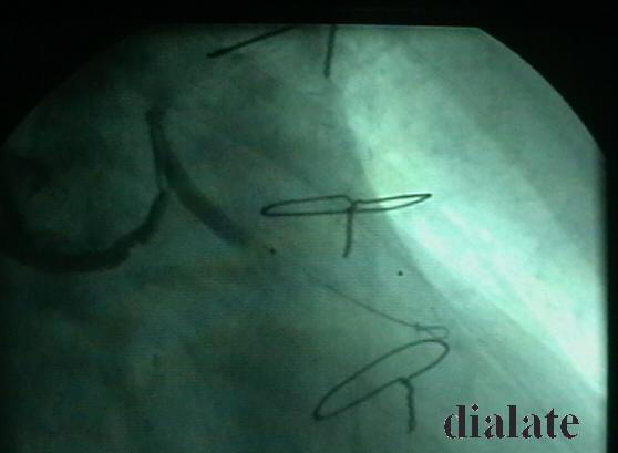 韩志华2007年德国进修日记(十)