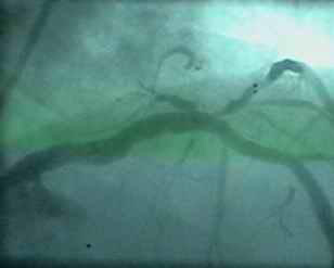 韩志华2007年德国进修日记(十)