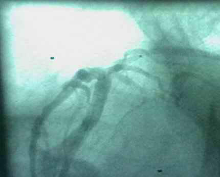 韩志华2007年德国进修日记(十)